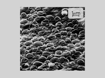 Клетки Sulfolobus acidocaldarius. Электронная микрофотография с сайта tms.org Клетки Sulfolobus acidocaldarius. Электронная микрофотография с сайта tms.org